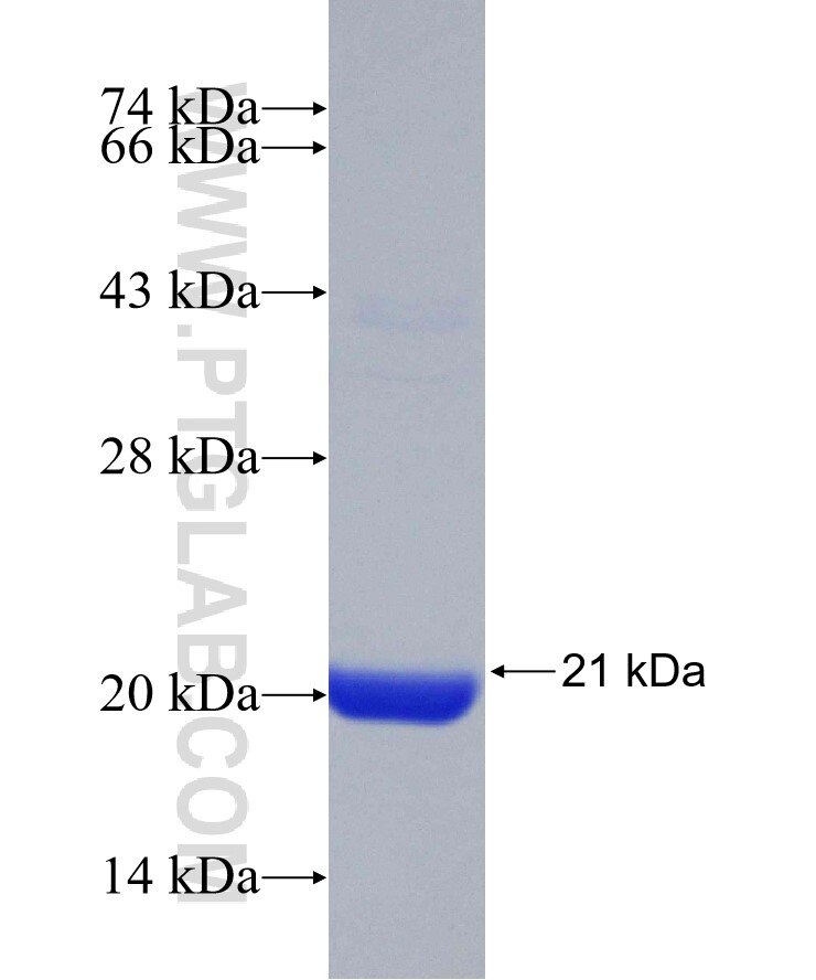 KLHL32 fusion protein Ag29014 SDS-PAGE