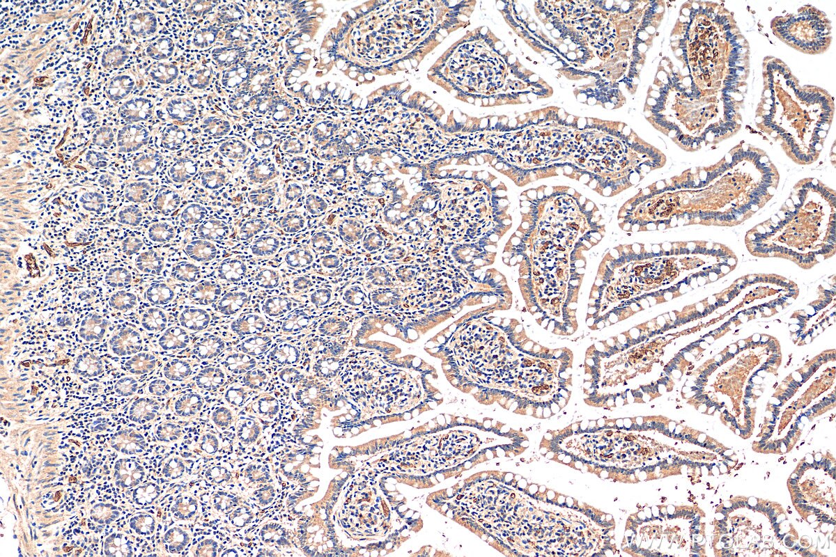 Immunohistochemistry (IHC) staining of human small intestine tissue using KLHL34 Polyclonal antibody (21981-1-AP)