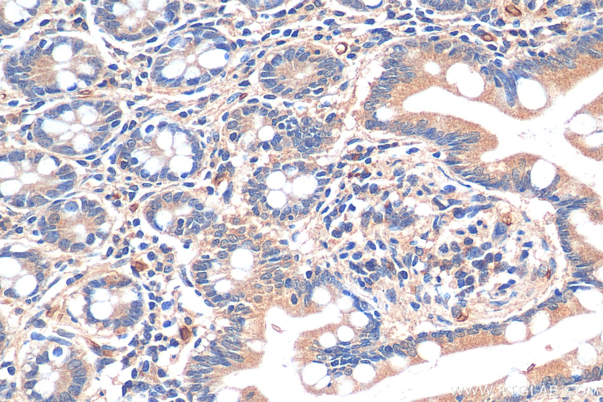 Immunohistochemistry (IHC) staining of human small intestine tissue using KLHL34 Polyclonal antibody (21981-1-AP)