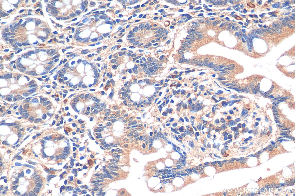 Immunohistochemistry (IHC) staining of human small intestine tissue using KLHL34 Polyclonal antibody (21981-1-AP)