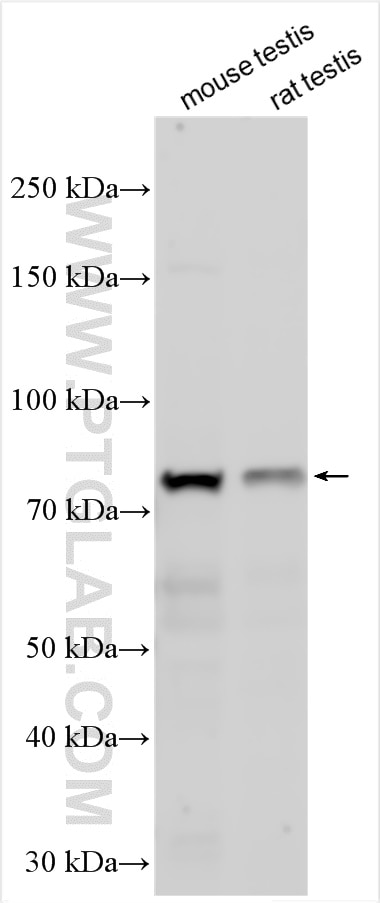 Western Blot (WB) analysis of various lysates using KLHL34 Polyclonal antibody (21981-1-AP)