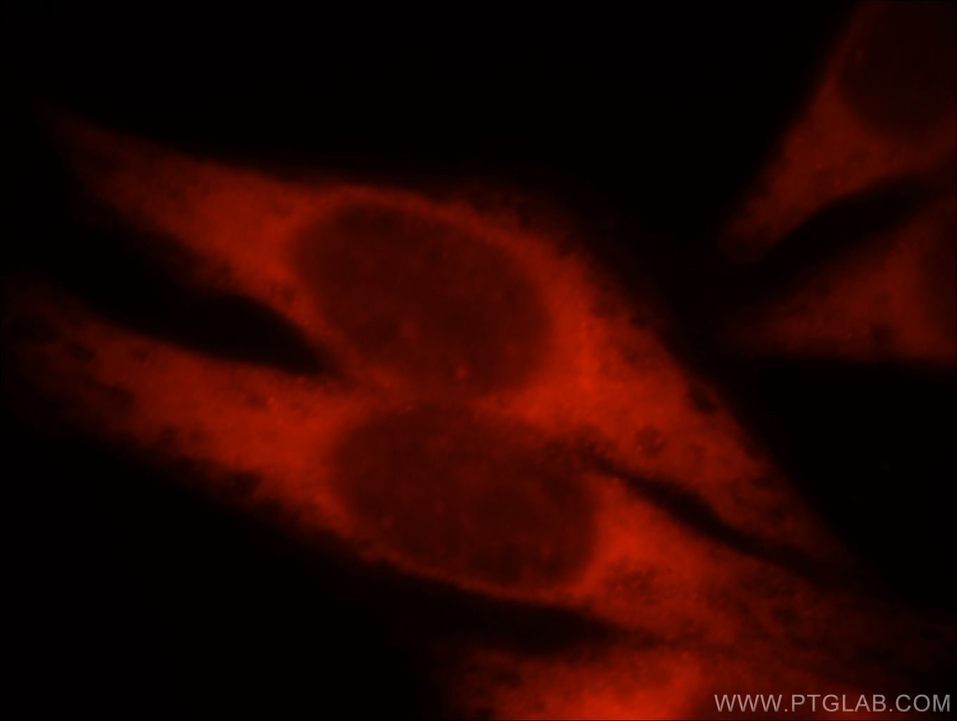 Immunofluorescence (IF) / fluorescent staining of HeLa cells using KLHL35 Polyclonal antibody (21199-1-AP)
