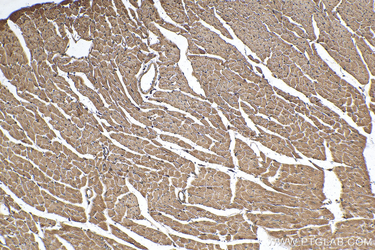 Immunohistochemistry (IHC) staining of mouse heart tissue using KLHL35 Polyclonal antibody (21199-1-AP)