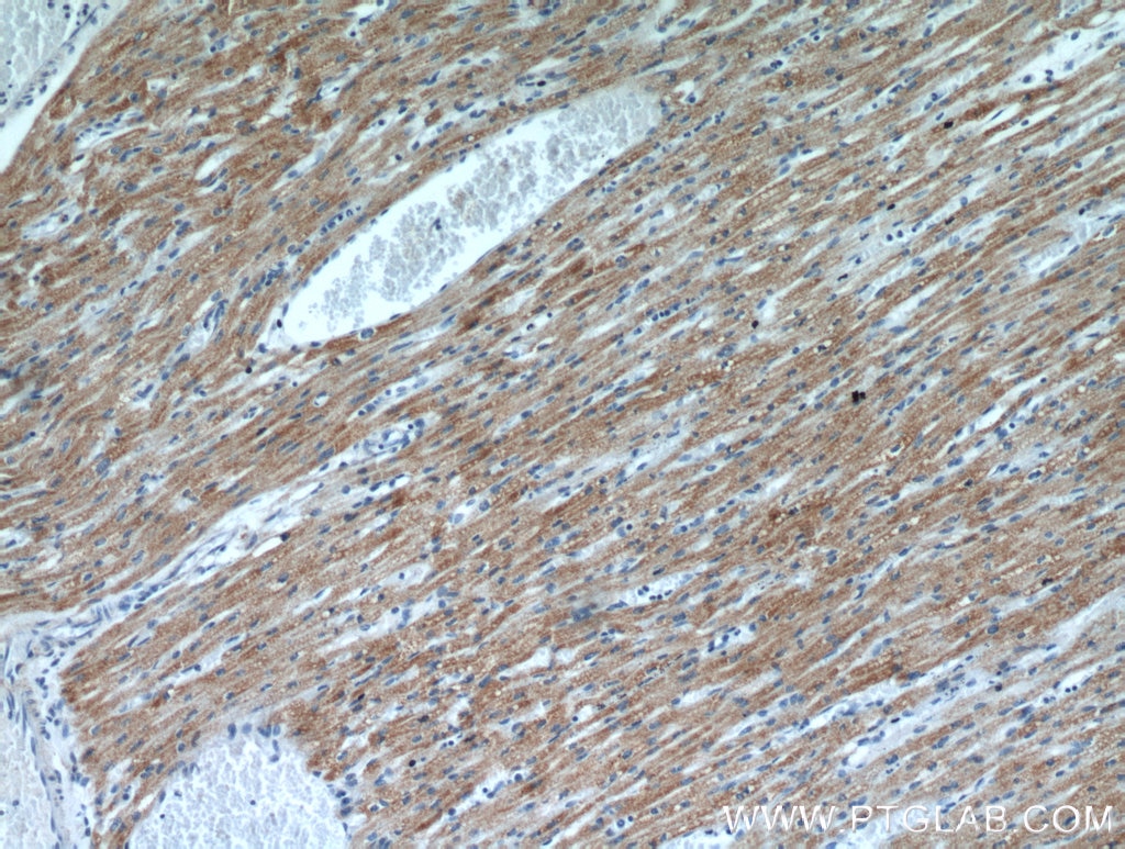 Immunohistochemistry (IHC) staining of human heart tissue using KLHL35 Polyclonal antibody (21199-1-AP)