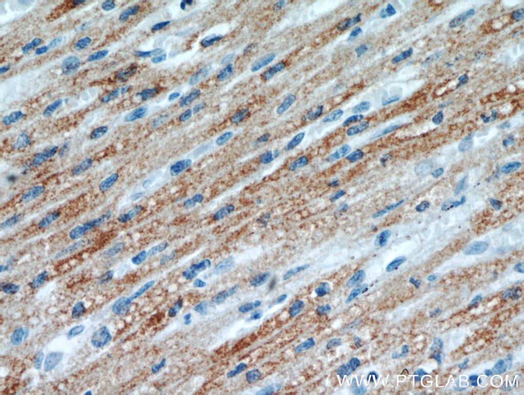 Immunohistochemistry (IHC) staining of human heart tissue using KLHL35 Polyclonal antibody (21199-1-AP)