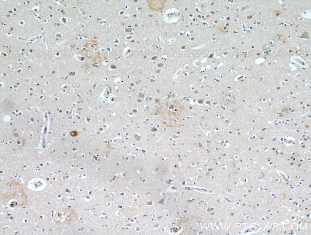 Immunohistochemistry (IHC) staining of human brain tissue using KLHL4 Polyclonal antibody (21191-1-AP)