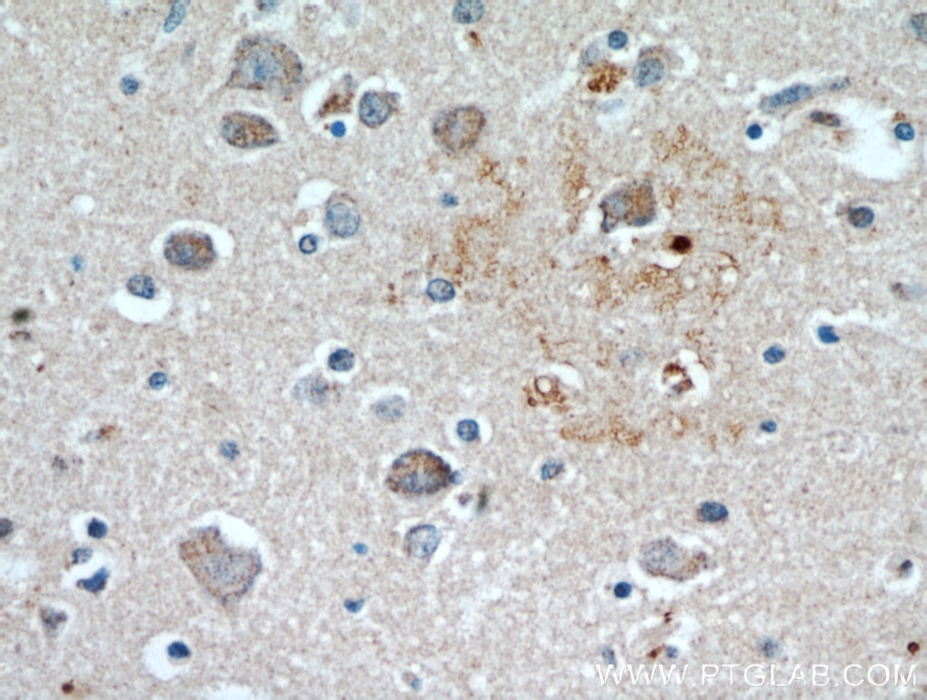 Immunohistochemistry (IHC) staining of human brain tissue using KLHL4 Polyclonal antibody (21191-1-AP)