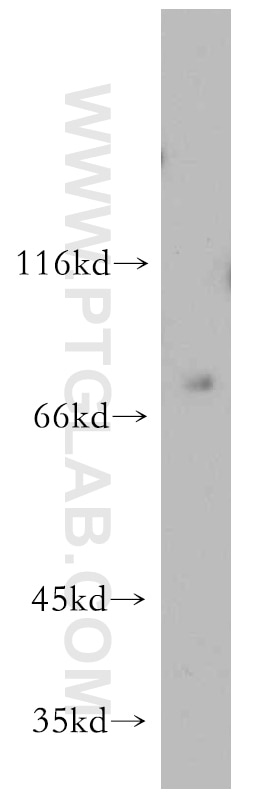 Western Blot (WB) analysis of HeLa cells using KLHL4 Polyclonal antibody (21191-1-AP)