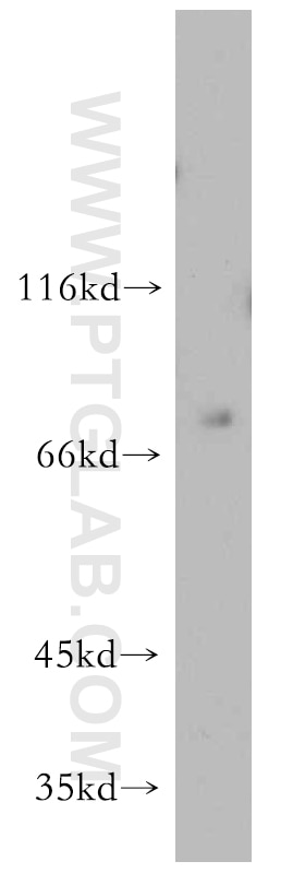 WB analysis of HeLa using 21191-1-AP