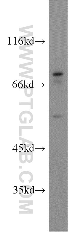 Western Blot (WB) analysis of HeLa cells using KLHL4 Polyclonal antibody (21191-1-AP)