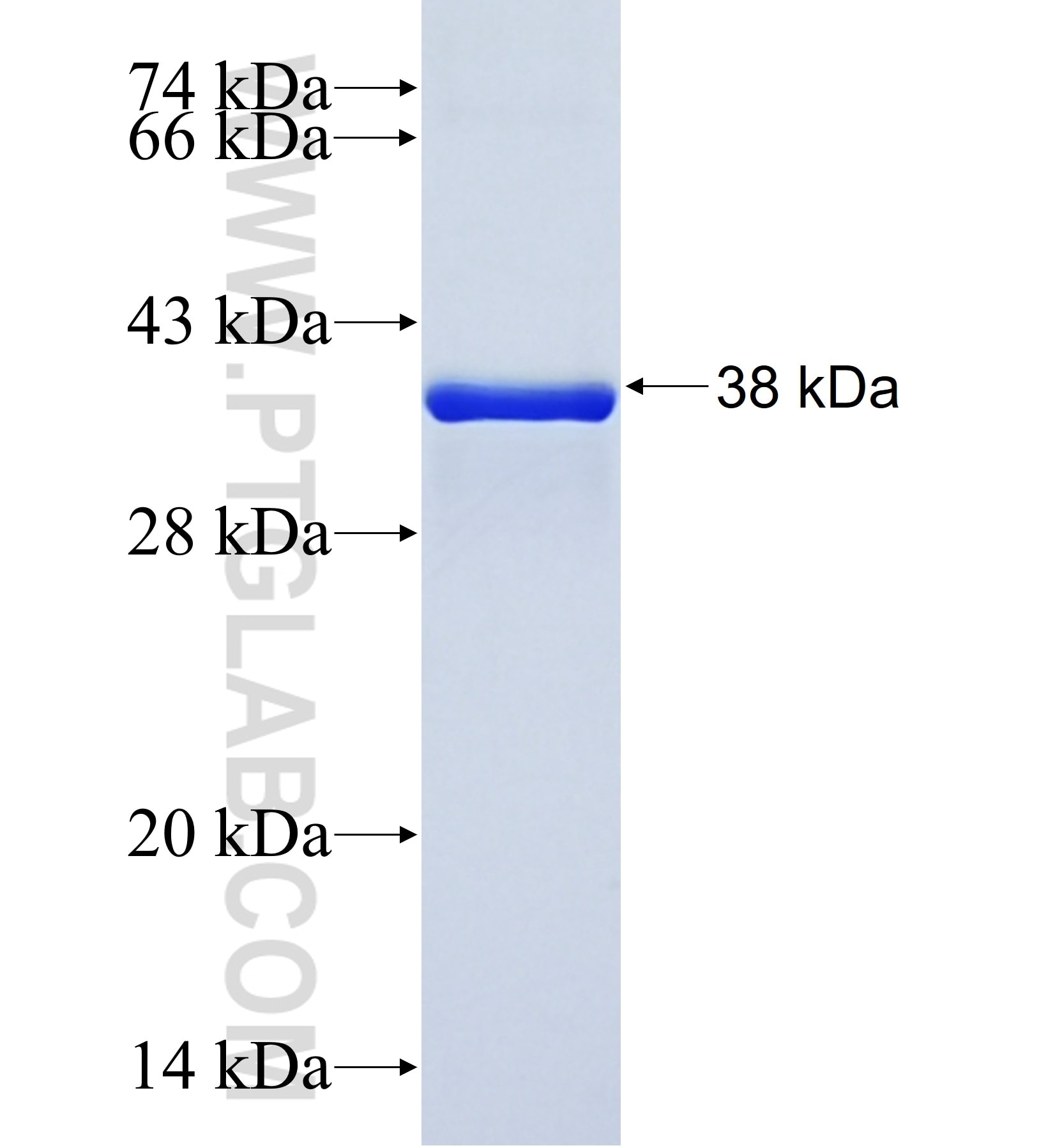 KLHL4 fusion protein Ag41970 SDS-PAGE KLHL4 fusion protein Ag41970 SDS-PAGE