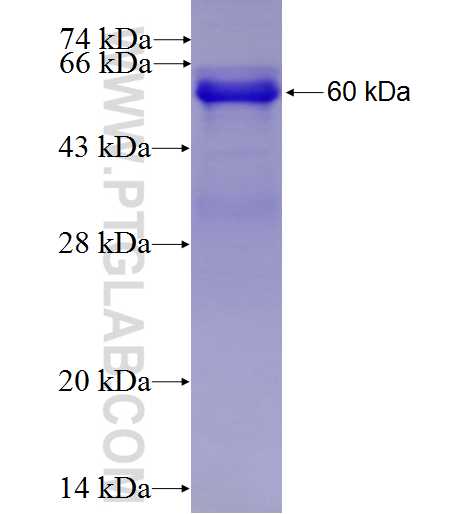 KLHL6 fusion protein Ag4441 SDS-PAGE