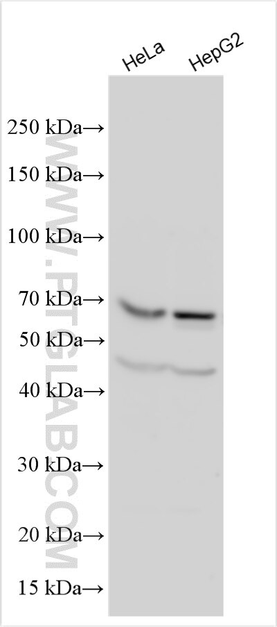 Western Blot (WB) analysis of various lysates using KLHL7 Polyclonal antibody (32697-1-AP)