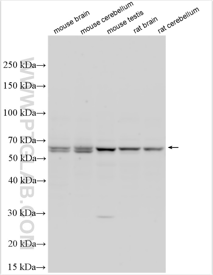 Western Blot (WB) analysis of various lysates using KLHL7 Polyclonal antibody (32697-1-AP)