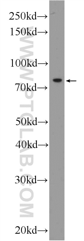 Western Blot (WB) analysis of HeLa cells using KLHL9 Polyclonal antibody (55394-1-AP)
