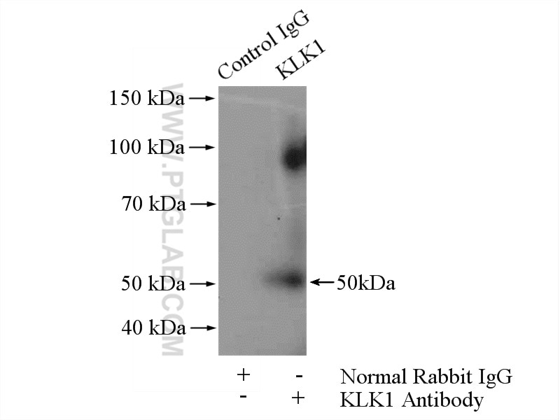 Immunoprecipitation (IP) experiment of BxPC-3 cells using Kallikrein 1 Polyclonal antibody (10815-1-AP)