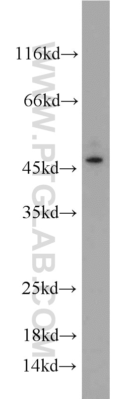 Western Blot (WB) analysis of A375 cells using Kallikrein 1 Polyclonal antibody (10815-1-AP)