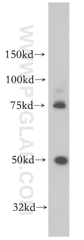 Western Blot (WB) analysis of BxPC-3 cells using Kallikrein 1 Polyclonal antibody (10815-1-AP)