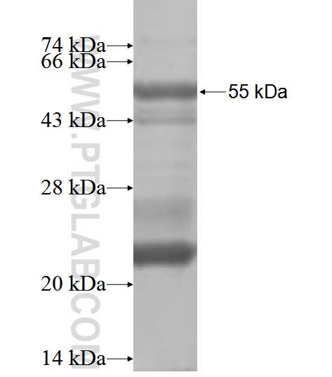 KLK1 fusion protein Ag1119 SDS-PAGE