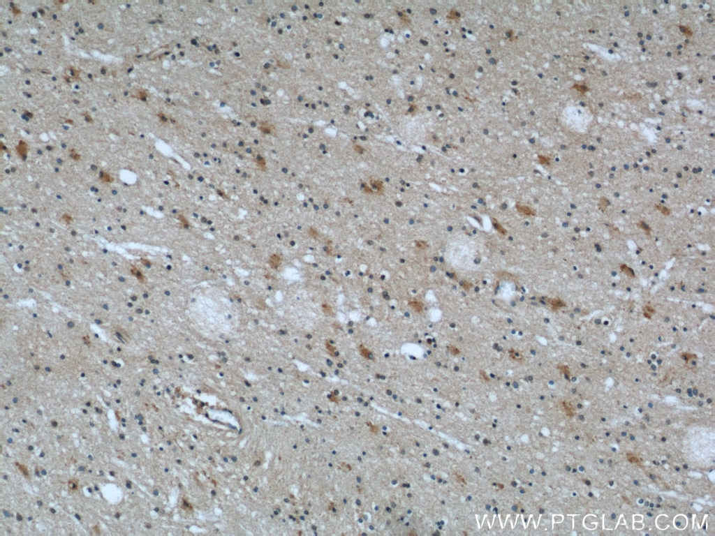 IHC staining of human brain using 12698-1-AP