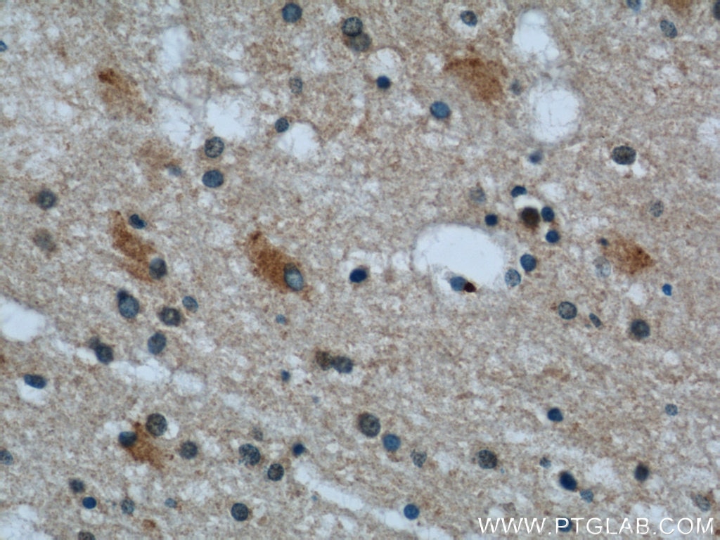 IHC staining of human brain using 12698-1-AP