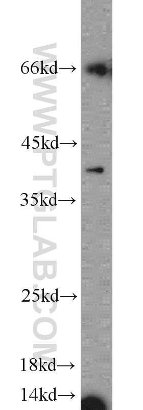 Western Blot (WB) analysis of MCF-7 cells using Kallikrein 11 Polyclonal antibody (12698-1-AP)