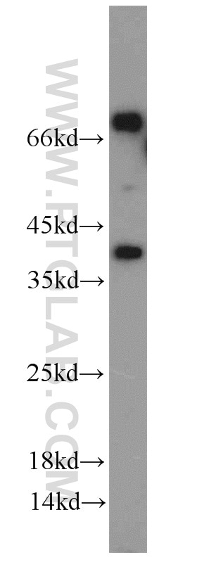 Western Blot (WB) analysis of HeLa cells using Kallikrein 11 Polyclonal antibody (12698-1-AP)