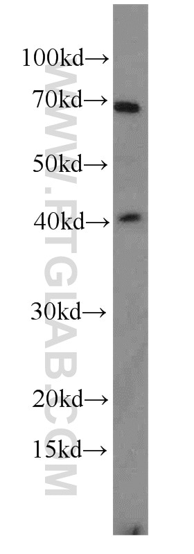 Western Blot (WB) analysis of Y79 cells using Kallikrein 11 Polyclonal antibody (12698-1-AP)