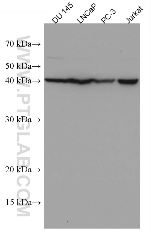 Western Blot (WB) analysis of various lysates using KLK11 Monoclonal antibody (67427-1-Ig)