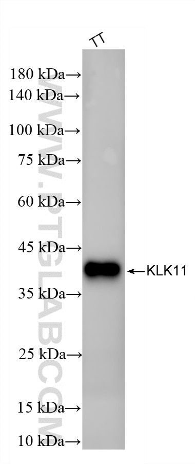 TT cells were subjected to SDS PAGE followed by western blot with 86517-1-RR (KLK11 antibody) at dilution of 1:10000 incubated at room temperature for 1.5 hours. Western Blot (WB) analysis of TT cells using KLK11 Recombinant monoclonal antibody (86517-1-RR)