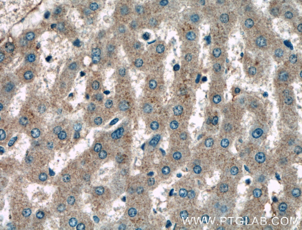 Immunohistochemistry (IHC) staining of human liver tissue using KLK15 Polyclonal antibody (27515-1-AP)
