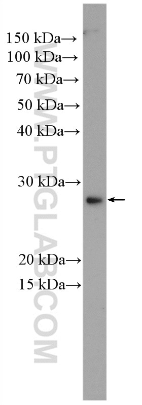 Western Blot (WB) analysis of SMMC-7721 cells using KLK15 Polyclonal antibody (27515-1-AP)