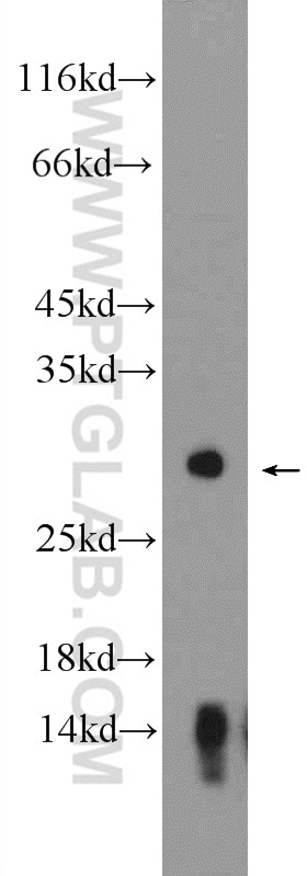 Western Blot (WB) analysis of mouse pancreas tissue using Kallikrein 2 Polyclonal antibody (10812-1-AP)