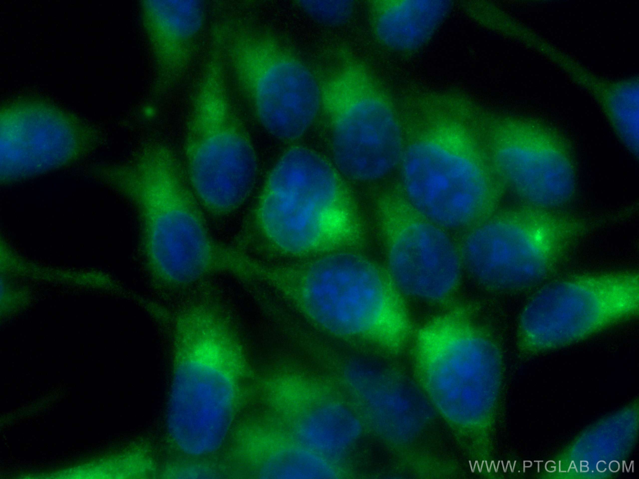 Immunofluorescence (IF) / fluorescent staining of LNCaP cells using KLK3/PSA Polyclonal antibody (10679-1-AP)