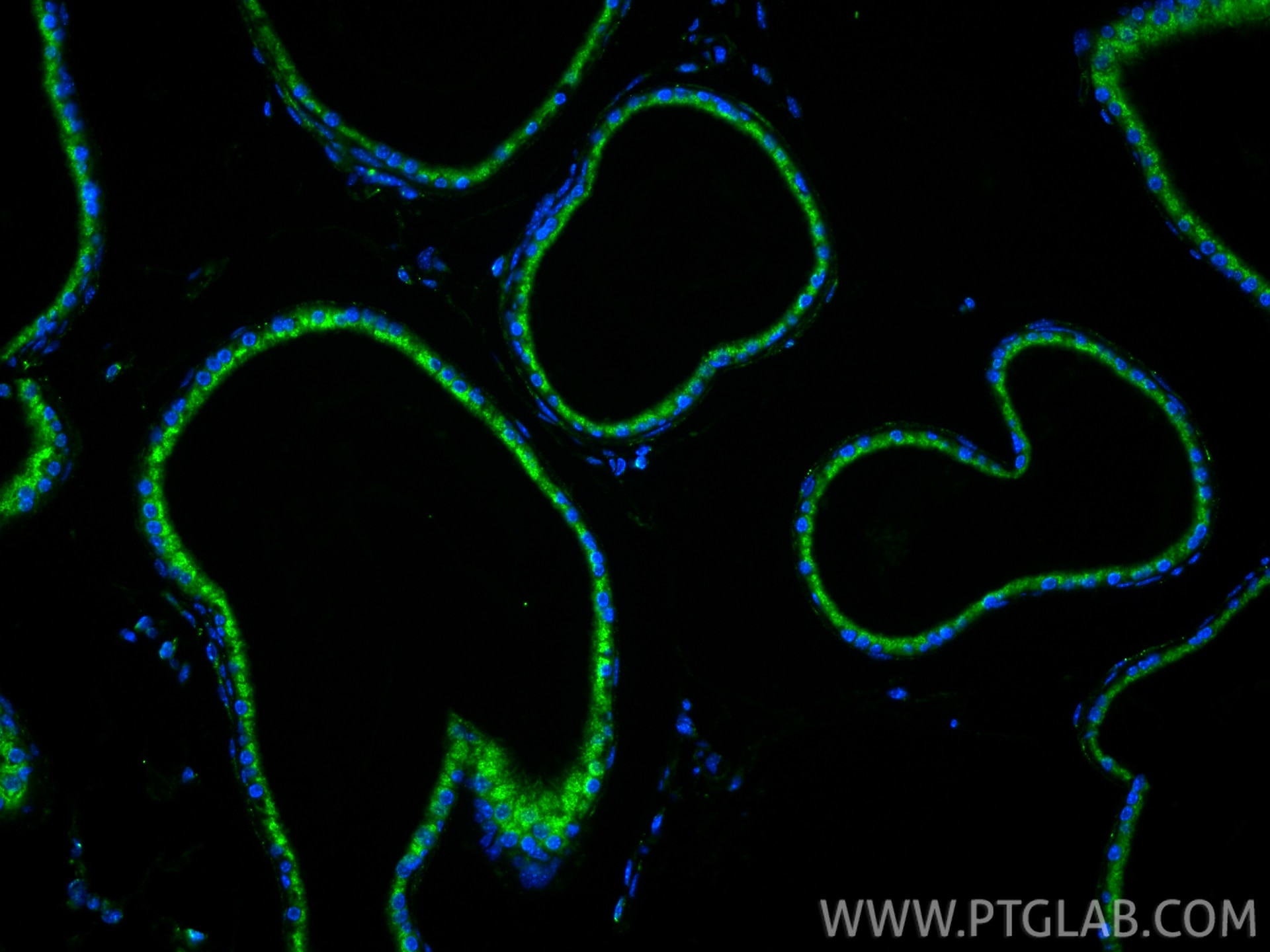 Immunofluorescence (IF) / fluorescent staining of mouse prostate tissue using KLK3/PSA Polyclonal antibody (10679-1-AP)