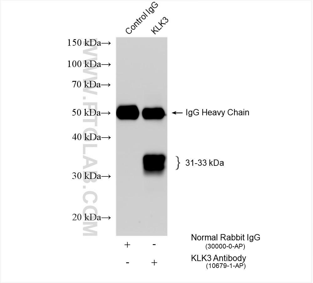 Immunoprecipitation (IP) experiment of LNCaP cells using KLK3/PSA Polyclonal antibody (10679-1-AP)