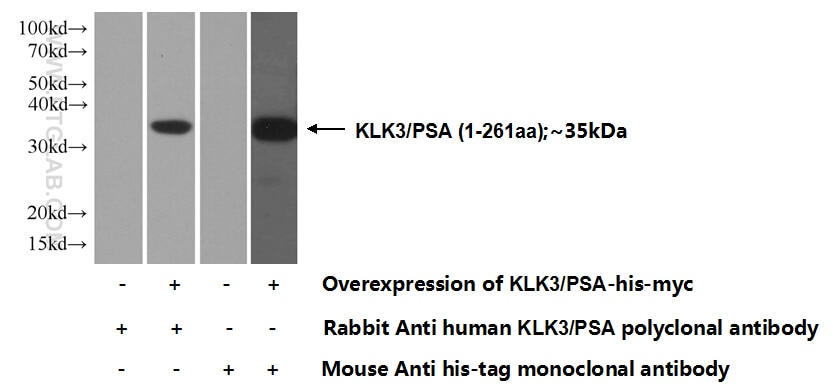 Western Blot (WB) analysis of Transfected HEK-293 cells using KLK3/PSA Polyclonal antibody (10679-1-AP)