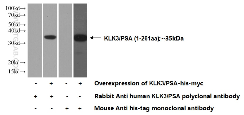 WB analysis of Transfected HEK-293 using 10679-1-AP