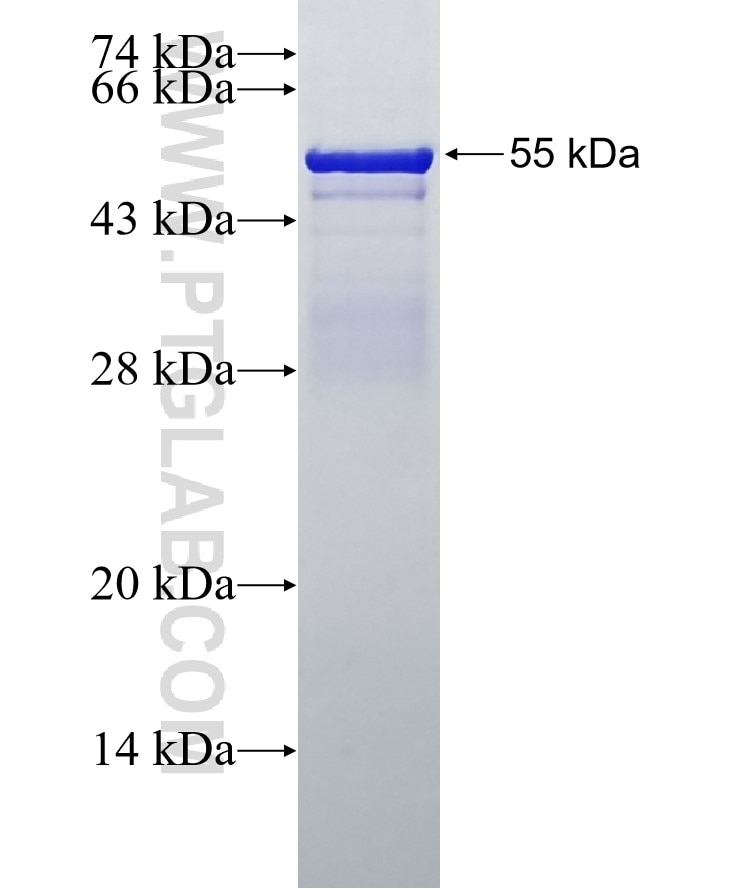 KLK3,PSA fusion protein Ag1060 SDS-PAGE
