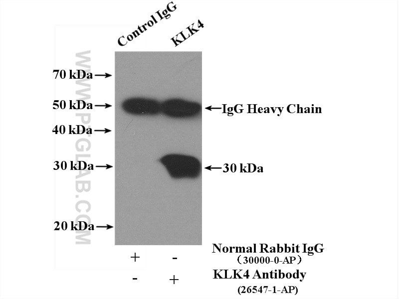 Immunoprecipitation (IP) experiment of DU 145 cells using KLK4 Polyclonal antibody (26547-1-AP)