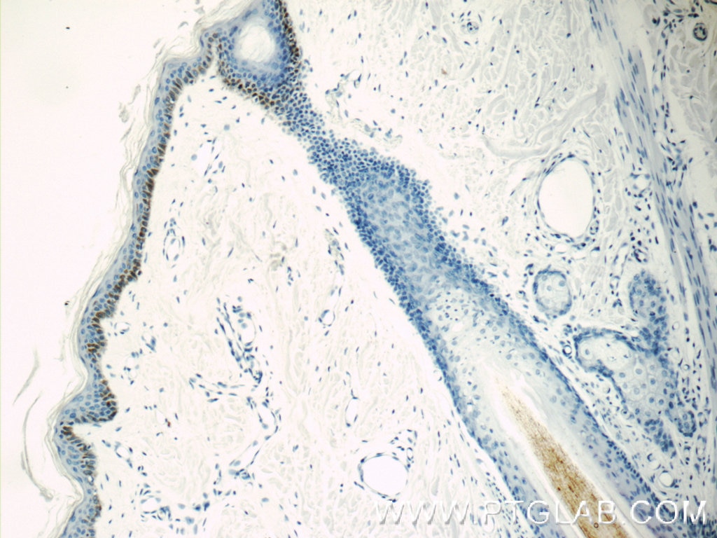 Immunohistochemistry (IHC) staining of human skin tissue using Kallikrein 5 Polyclonal antibody (10514-2-AP)