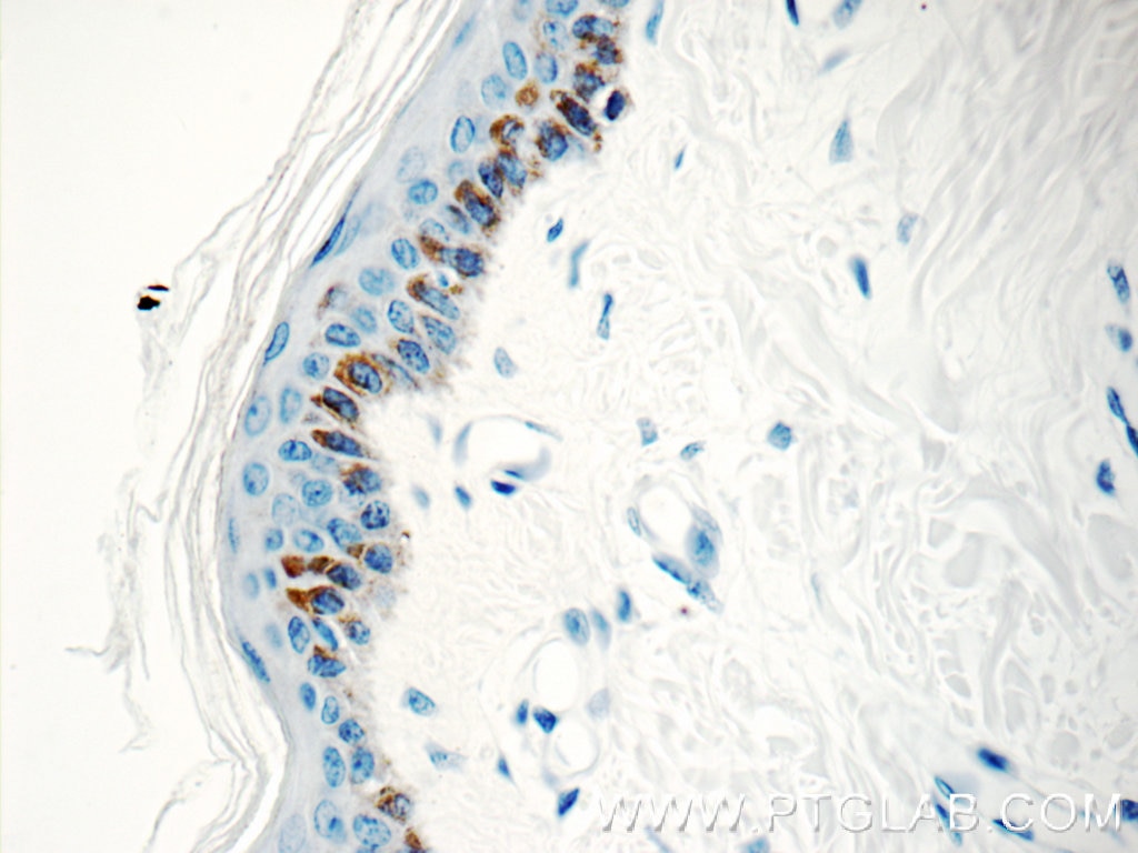 Immunohistochemistry (IHC) staining of human skin tissue using Kallikrein 5 Polyclonal antibody (10514-2-AP)