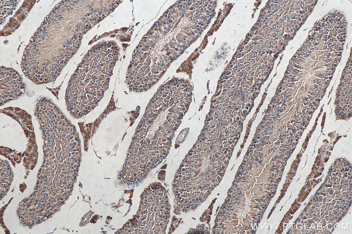 Immunohistochemistry (IHC) staining of mouse testis tissue using Kallikrein 5 Polyclonal antibody (10514-2-AP)