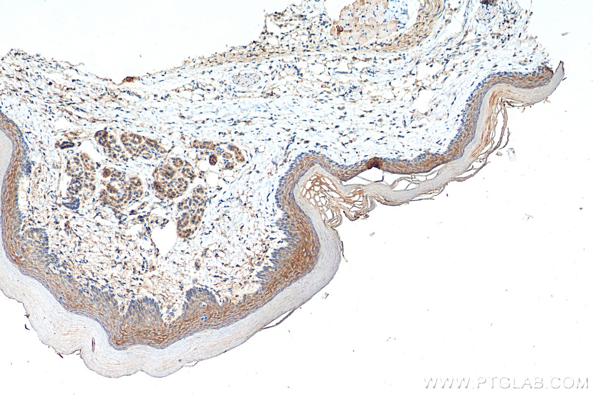 Immunohistochemistry (IHC) staining of mouse skin tissue using Kallikrein 5 Polyclonal antibody (10514-2-AP)