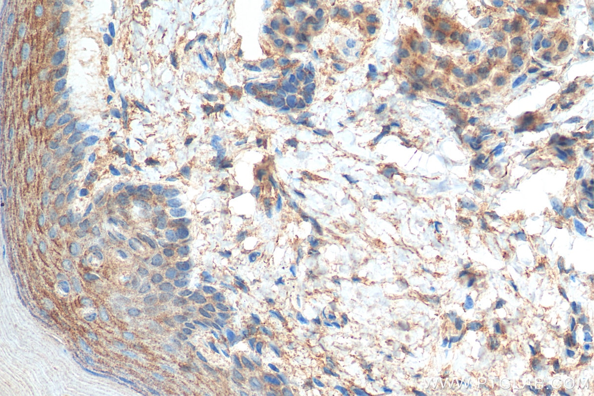 Immunohistochemistry (IHC) staining of mouse skin tissue using Kallikrein 5 Polyclonal antibody (10514-2-AP)