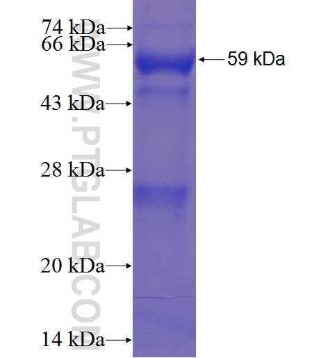 KLK5 fusion protein Ag0799 SDS-PAGE