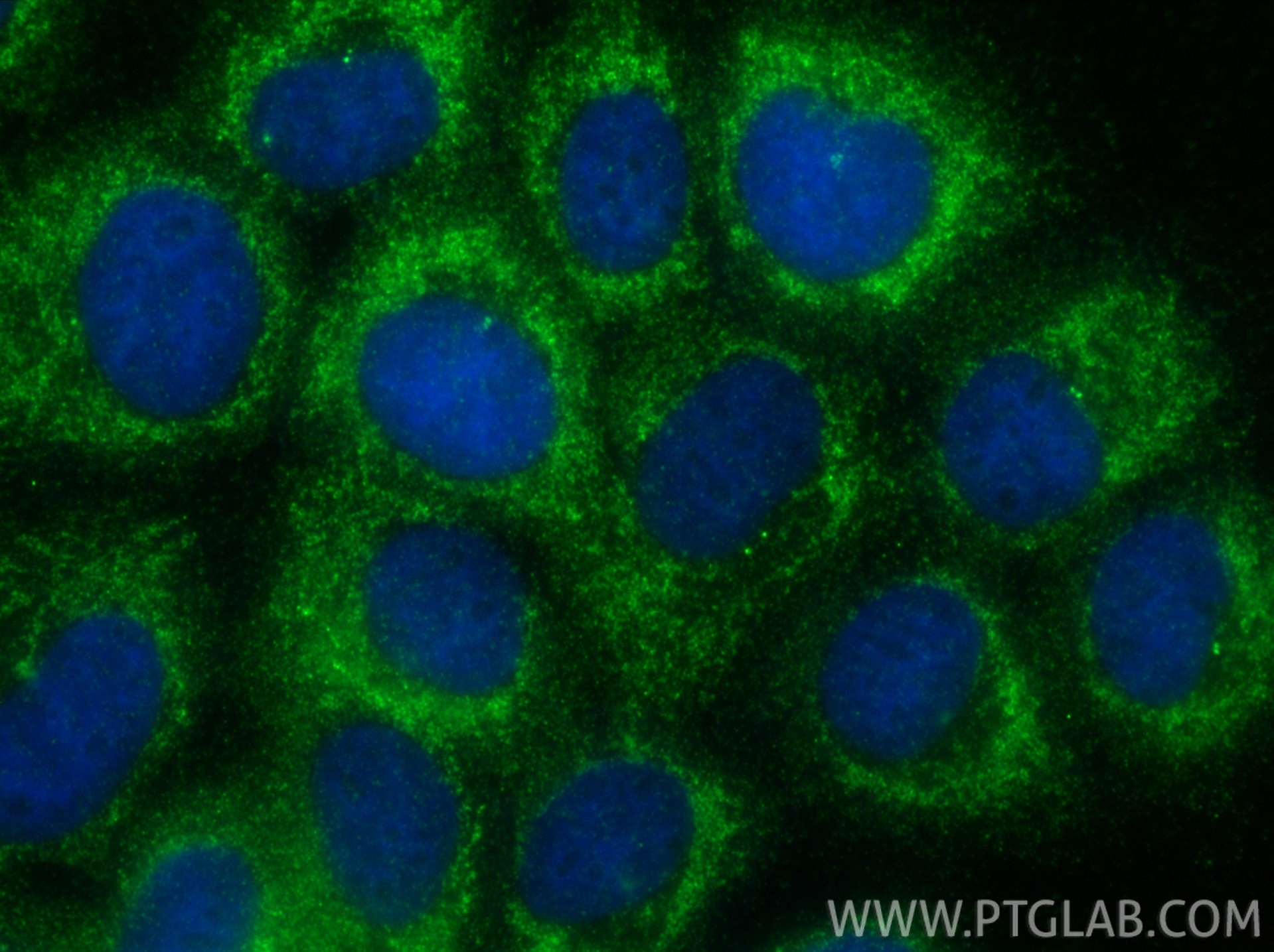 Immunofluorescence (IF) / fluorescent staining of A431 cells using Kallikrein 7 Polyclonal antibody (23810-1-AP)
