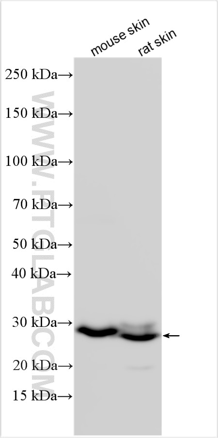 Western Blot (WB) analysis of various lysates using Kallikrein 7 Polyclonal antibody (23810-1-AP)