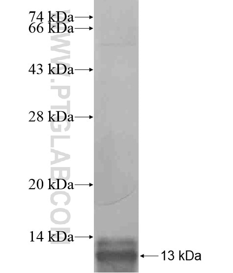 KLK7 fusion protein Ag20760 SDS-PAGE
