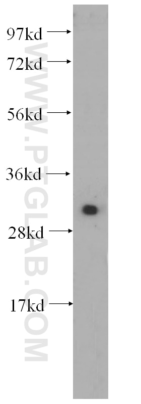 Western Blot (WB) analysis of HeLa cells using Kallikrein 8 Polyclonal antibody (14232-1-AP)